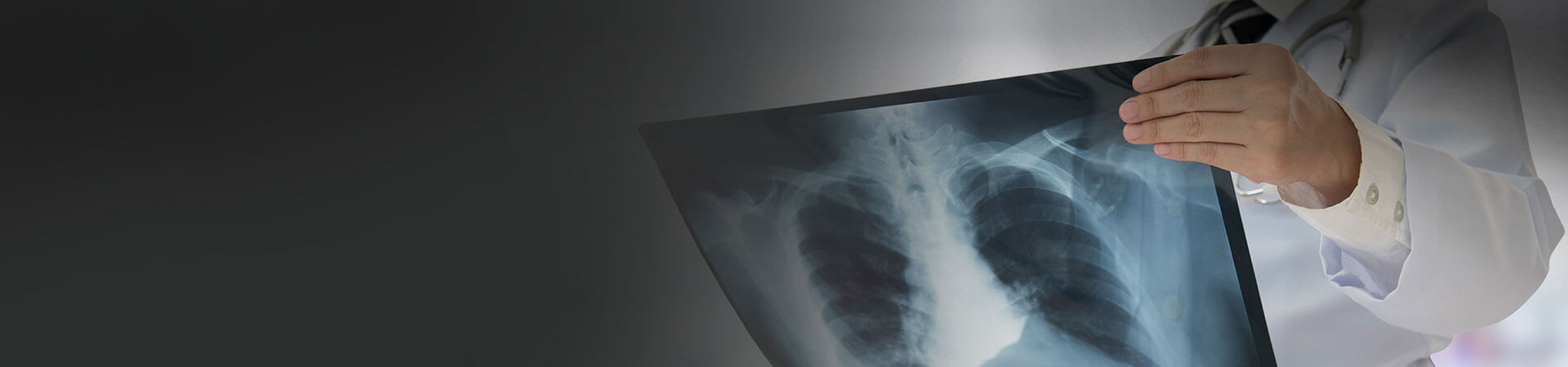 Catastrophic Injuries